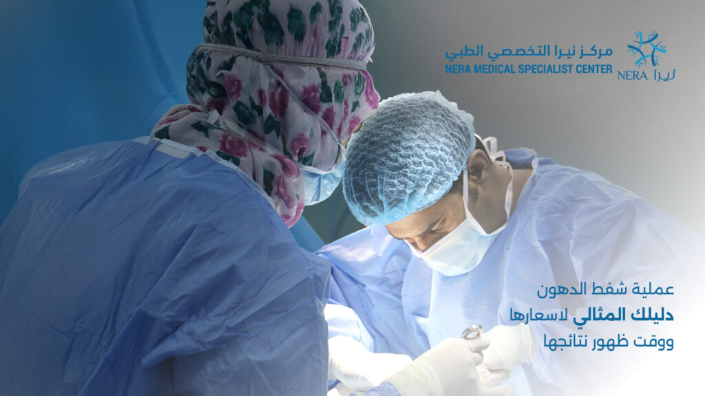 عملية شفط الدهون